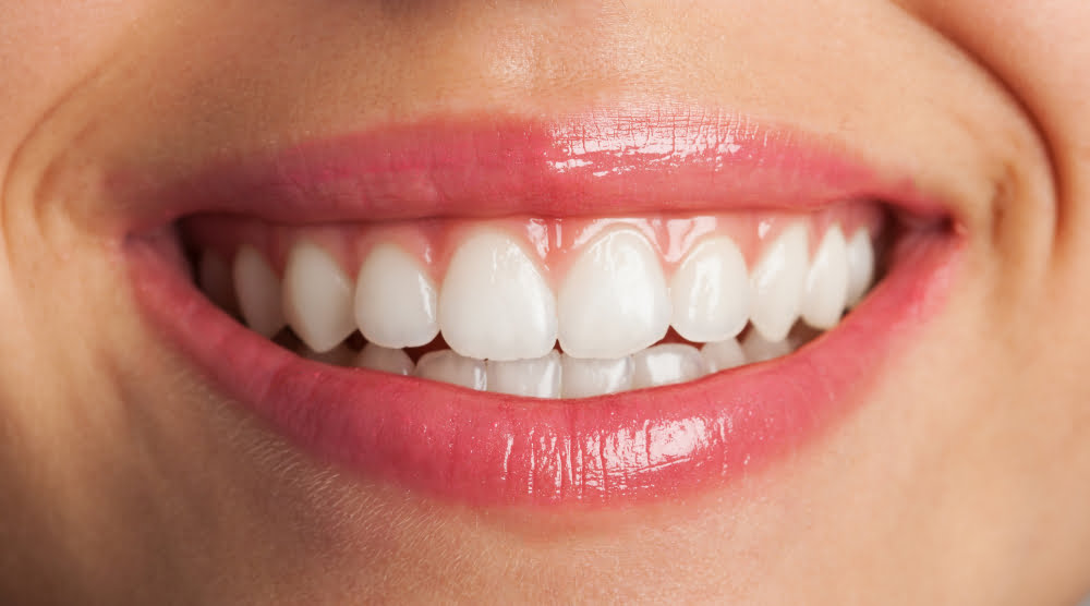 Quais os Procedimentos de Estética para os Dentes mais comuns 2 close up perfect smile