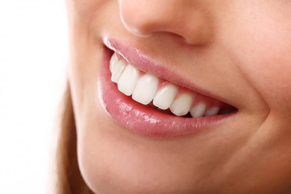 Quais os Procedimentos de Estética para os Dentes mais comuns 4 Estética para os Dentes